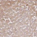 Anti-C14orf178 Antibody