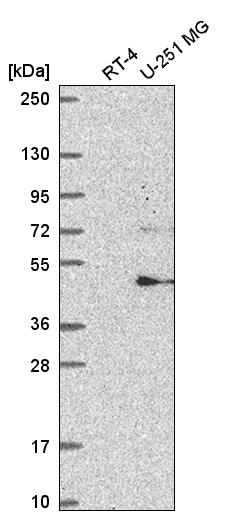Anti-FBXW11 Antibody