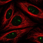 Immunofluorescent staining of human cell line SiHa shows localization to nucleoli & vesicles.