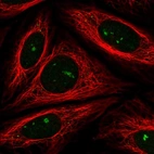 Immunofluorescent staining of human cell line SiHa shows localization to nucleoli & vesicles.