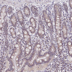 Immunohistochemical staining of human small intestine shows strong positivity in nucleoli in glandular cells.