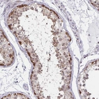 Immunohistochemical staining of human testis shows strong positivity in nucleoli in cells in seminiferous ducts.