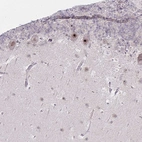Immunohistochemical staining of human cerebellum shows strong positivity in nucleoli in Purkinje cells.