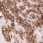 Anti-MSLN Antibody