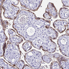 Anti-HMGB3 Antibody