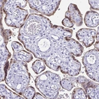 Immunohistochemical staining of human placenta shows moderate nuclear positivity in trophoblastic cells.