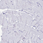 Anti-HMGB3 Antibody