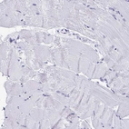 Immunohistochemical staining of human skeletal muscle shows no positivity in myocytes as expected.