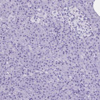 Immunohistochemical staining of human pancreas shows no positivity as expected.