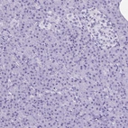 Immunohistochemical staining of human pancreas shows no positivity as expected.