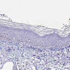 Anti-HMGB3 Antibody