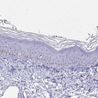 Immunohistochemical staining of human skin shows no positivity in squamous epithelial cells as expected.