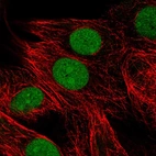 Immunofluorescent staining of human cell line MCF7 shows localization to nucleus & nucleoli.