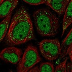 Anti-PNPLA2 Antibody