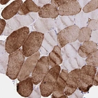 Immunohistochemical staining of human skeletal muscle shows strong cytoplasmic positivity in myocytes.
