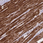 Immunohistochemical staining of human heart muscle shows strong cytoplasmic positivity in cardiomyocytes.