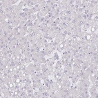 Immunohistochemical staining of human liver shows no positivity in hepatocytes as expected.
