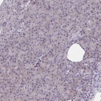 Immunohistochemical staining of human pancreas shows no cytoplasmic positivity in exocrine glandular cells as expected.