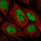 Immunofluorescent staining of human cell line SiHa shows localization to nucleoplasm.