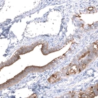 Immunohistochemical staining of human fallopian tube shows strong membranous positivity in glandular cells.