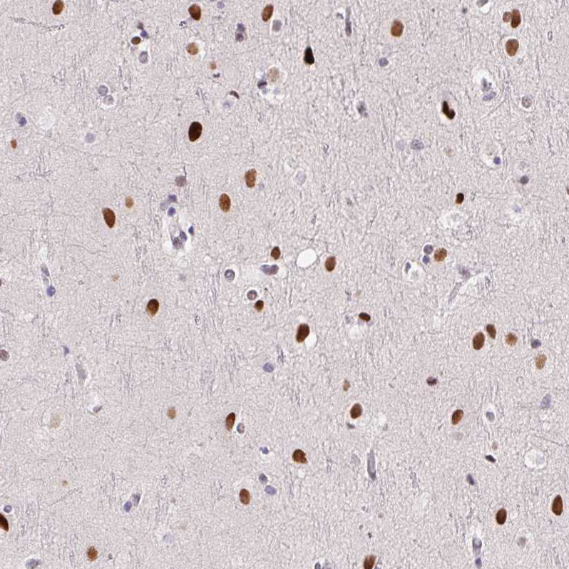 Anti-SP9 Antibody