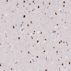 Anti-SP9 Antibody