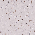 Anti-SP9 Antibody