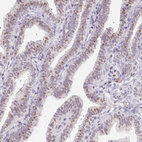 Immunohistochemical staining of human fallopian tube shows moderate nuclear positivity in glandular cells.