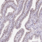 Immunohistochemical staining of human fallopian tube shows moderate nuclear positivity in glandular cells.