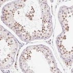 Immunohistochemical staining of human testis shows moderate nuclear positivity in cells in seminiferous ducts.