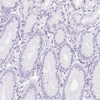 Immunohistochemical staining of human stomach shows no positivity in glandular cells as expected.