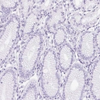 Immunohistochemical staining of human stomach shows no positivity in glandular cells as expected.