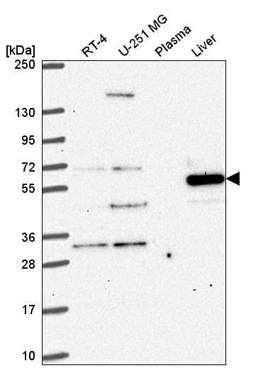 Anti-DENND6A Antibody