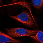 Immunofluorescent staining of human cell line U-2 OS shows localization to vesicles.
