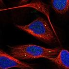 Immunofluorescent staining of human cell line U-2 OS shows localization to vesicles.