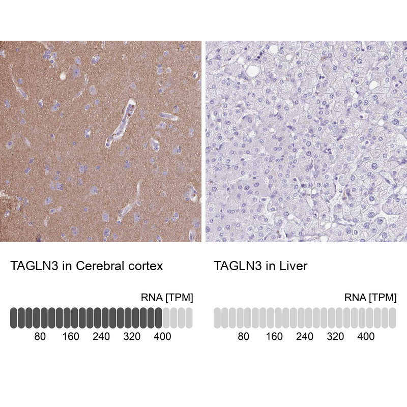 Anti-TAGLN3 Antibody