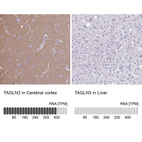 Anti-TAGLN3 Antibody