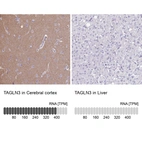 Anti-TAGLN3 Antibody