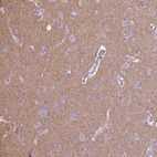 Immunohistochemical staining of human cerebral cortex shows moderate cytoplasmic positivity in neuropil.