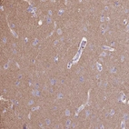 Immunohistochemical staining of human cerebral cortex shows moderate cytoplasmic positivity in neuropil.