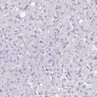Anti-TAGLN3 Antibody
