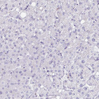Immunohistochemical staining of human liver shows no positivity in hepatocytes as expected.