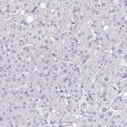 Immunohistochemical staining of human liver shows no positivity in hepatocytes as expected.