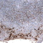 Immunohistochemical staining of human tonsil shows strong membranous positivity in squamous epithelial cells.