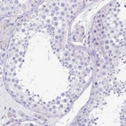 Immunohistochemical staining of human testis shows no positivity in cells in seminiferous ducts as expected.