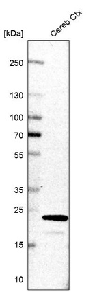 Western blot analysis in human cerebral cortex tissue.