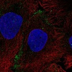 Anti-AQP10 Antibody