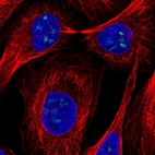 Anti-FTSJ3 Antibody