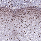 Anti-BHLHA9 Antibody