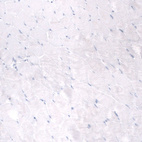 Anti-MSLN Antibody